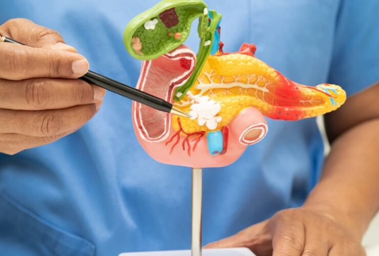 Laparoscopic Surgery